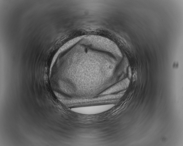 X0000099571156200806061556
