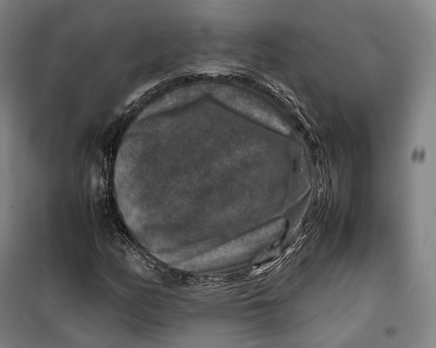 X0000099571158200806061556