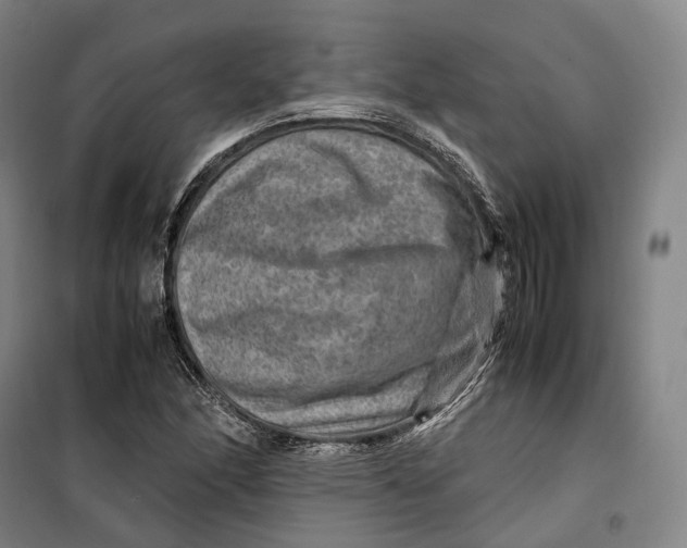 X0000099571166200806061556
