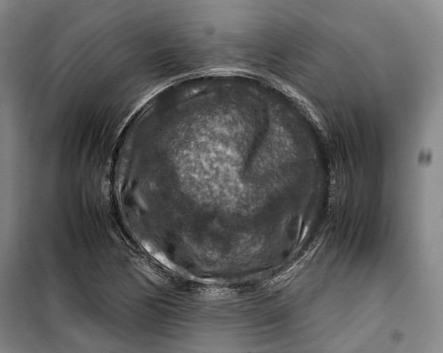 X0000099571170200806061556