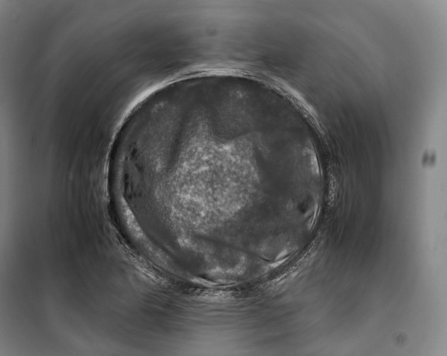 X0000099571174200806061556