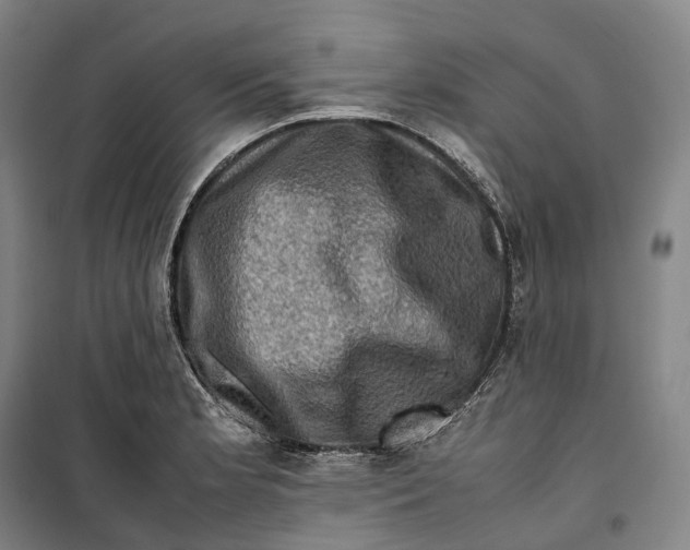 X0000099571181200806061556