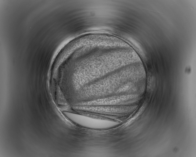 X0000099571196200806061555