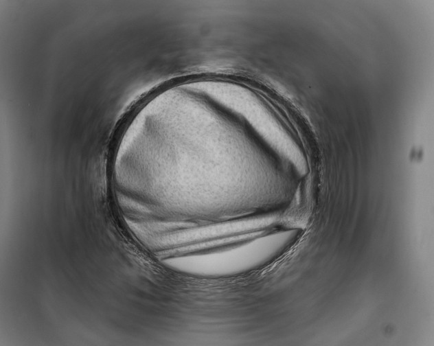 X0000099571214200806061555
