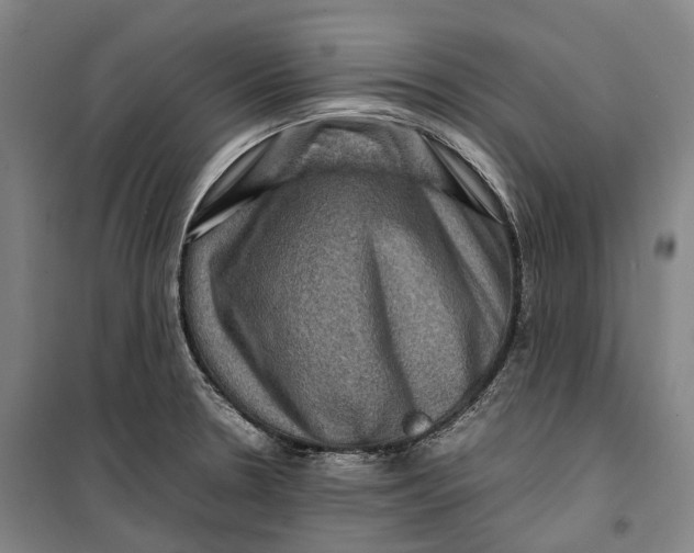 X0000099571330200806061554