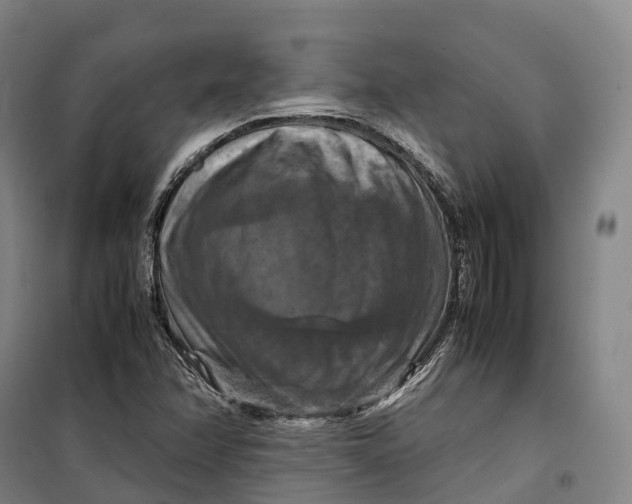 X0000099571358200806061553