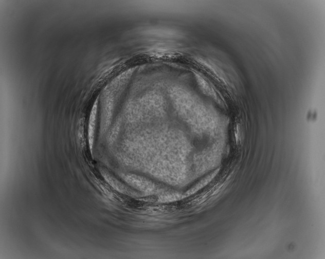 X0000099571396200806061552