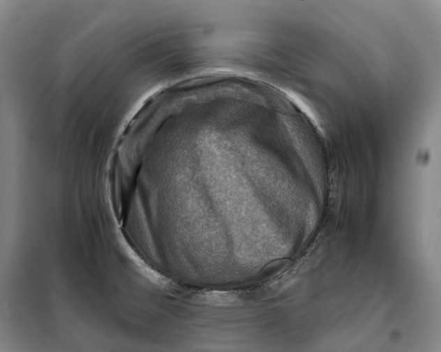 X0000099571476200806061551
