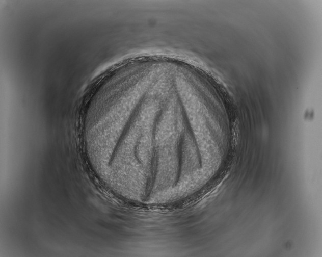 X0000099571494200806061550