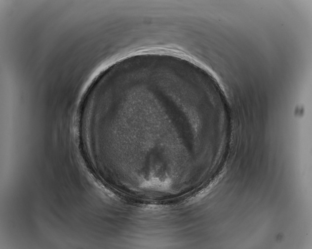 X0000099571506200806061550