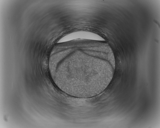 X0000099570040200806131306