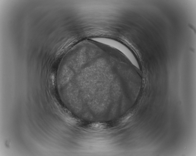X0000099570117200806131305
