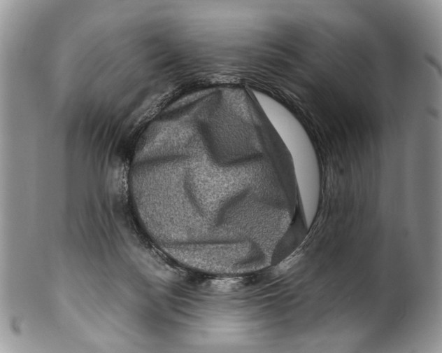 X0000099570172200806131304