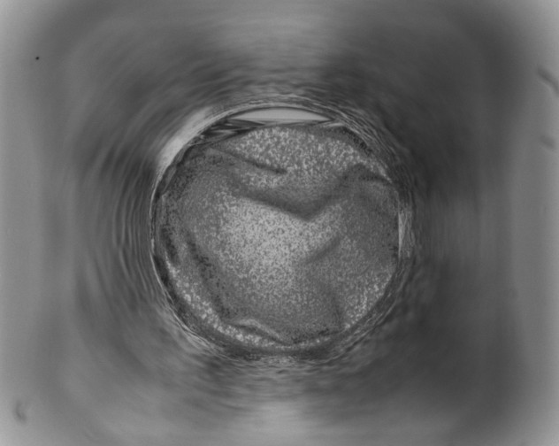 X0000099570195200806131304