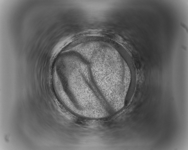 X0000099570293200806131302