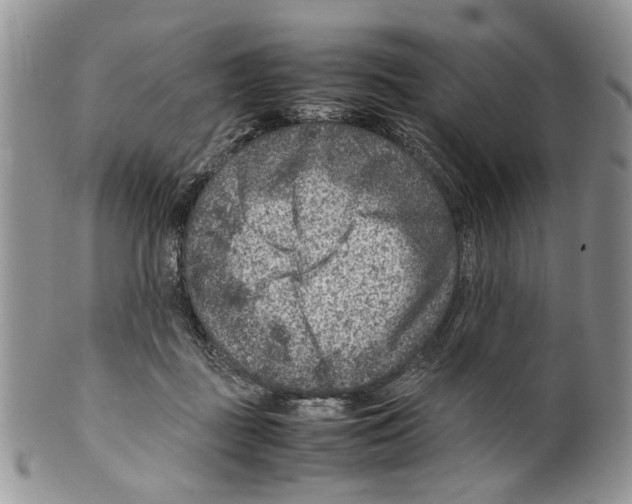 X0000099570363200806131301