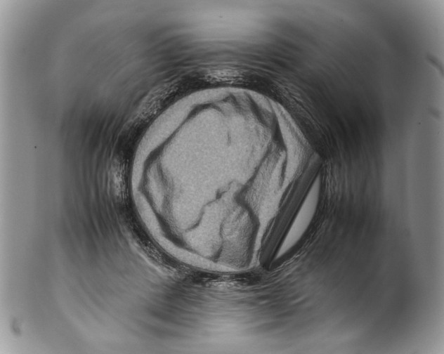 X0000099570408200806131301