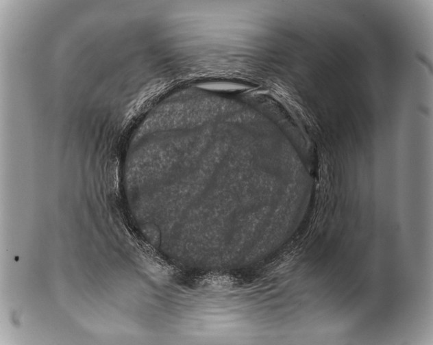 X0000099570685200806131257