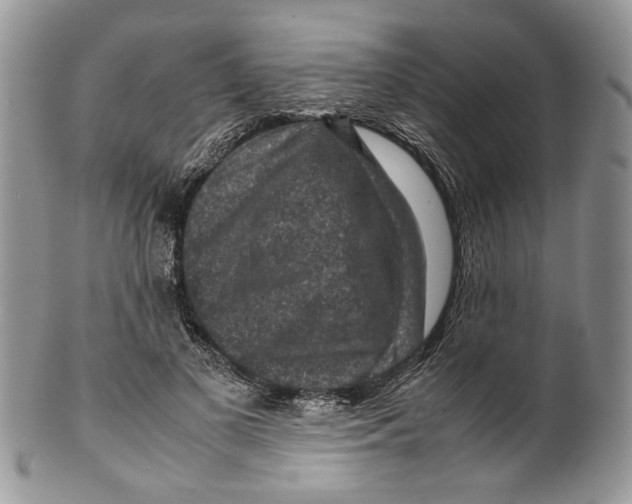 X0000099570693200806131257