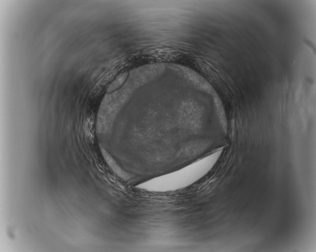 X0000099571010200806131251