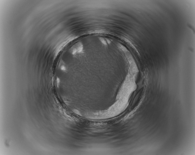 X0000099571117200806131250
