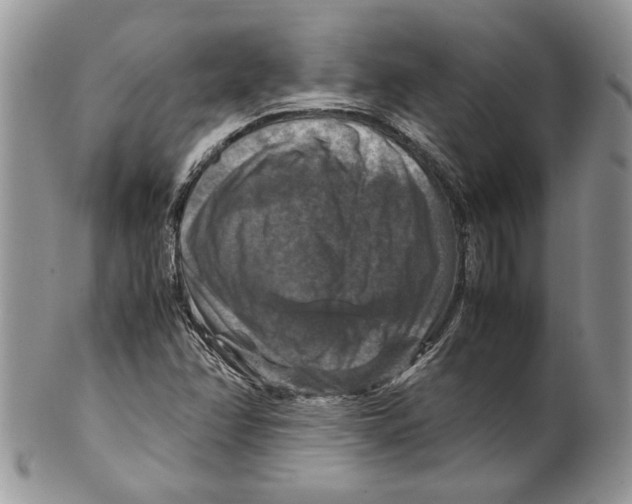X0000099571358200806131247