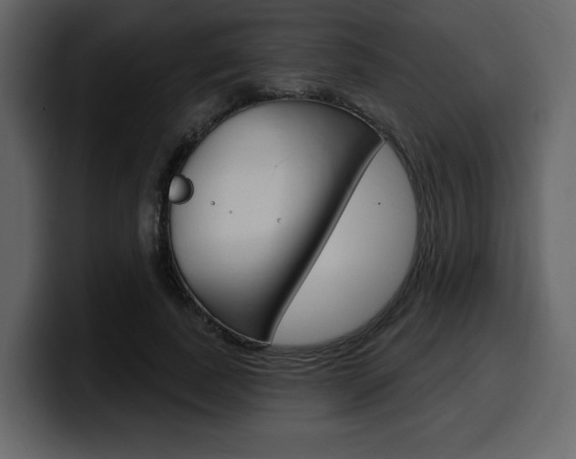 X0000099580739200805160745