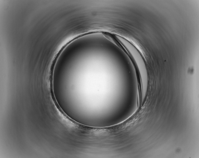 X0000099581143200805161229