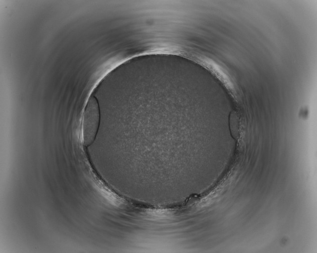 X0000099581276200805161227