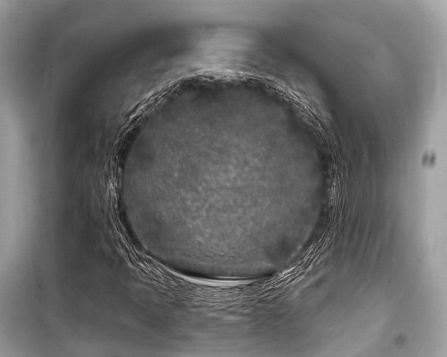 X0000099581397200805161224