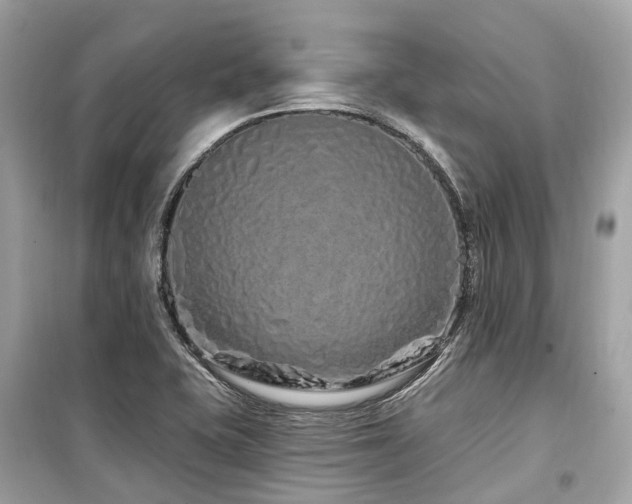 X0000099581415200805161225