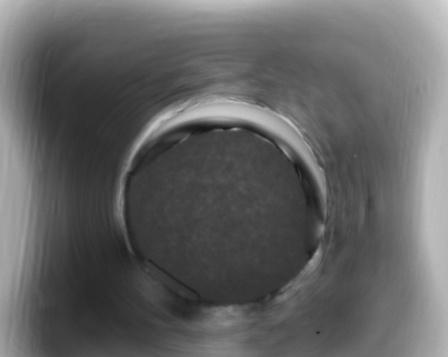 X0000099580100200805231558