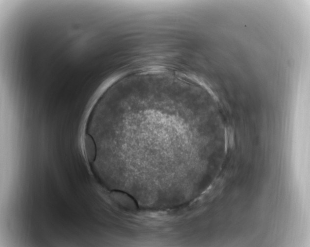 X0000099580147200805231557