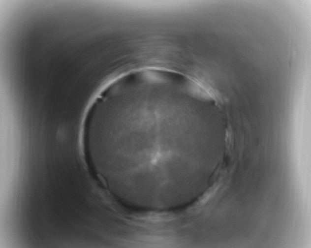 X0000099580292200805231556