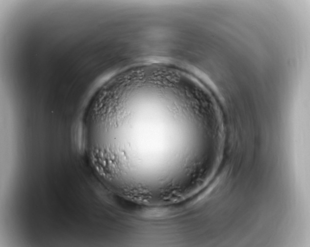X0000099581171200805231545