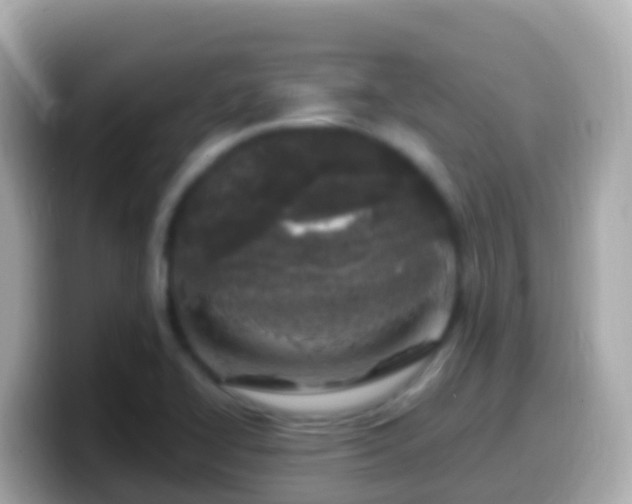 X0000099581414200805231542