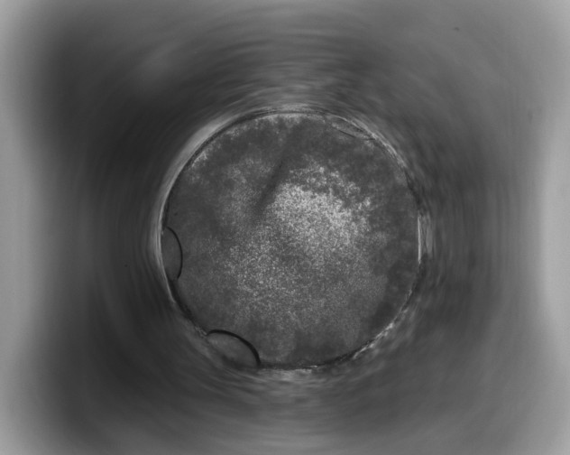 X0000099580147200805301606