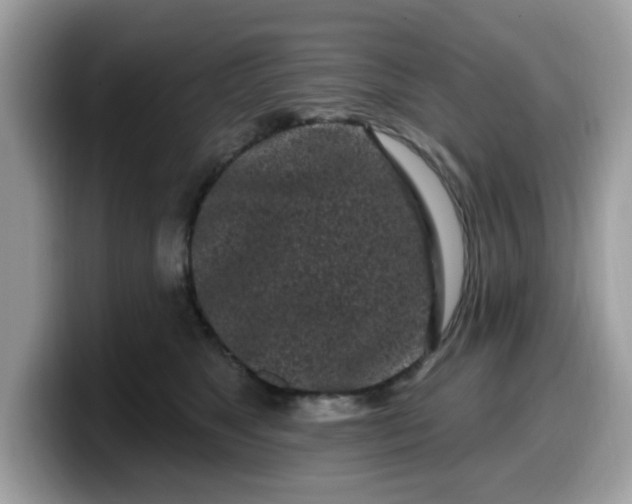 X0000099580517200805301602