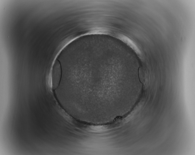 X0000099581276200805301552