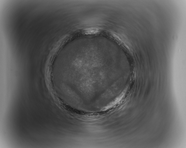 X0000099581441200805301551