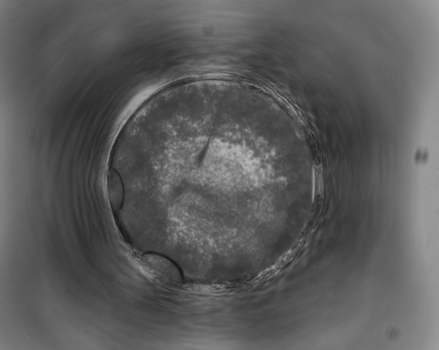 X0000099580147200806061635