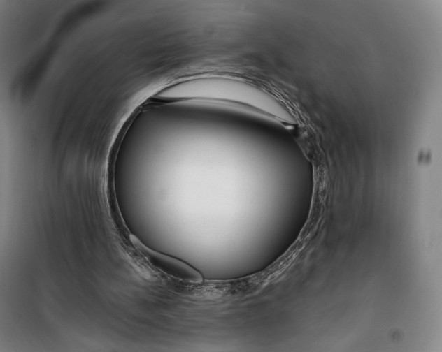 X0000099580148200806061635