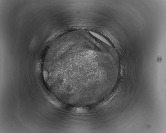 X0000099580165200806061635