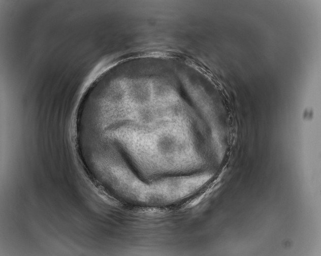 X0000099580198200806061635