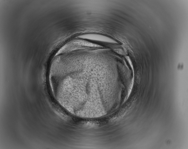 X0000099580303200806061633