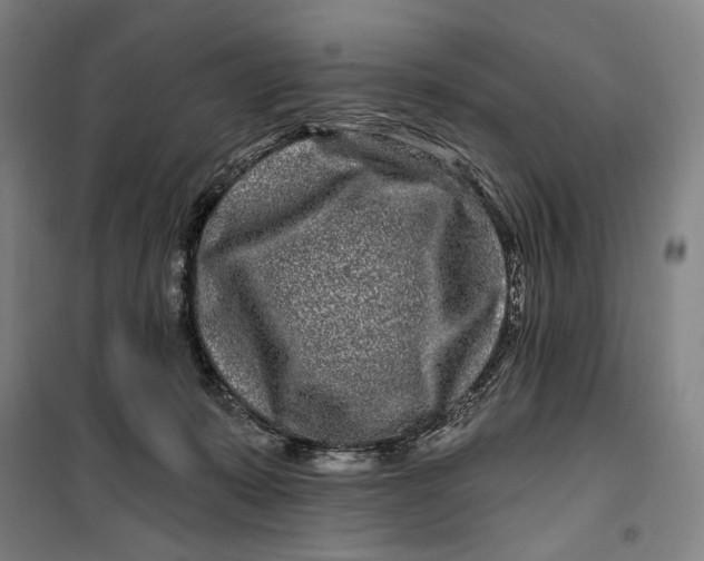 X0000099580319200806061633