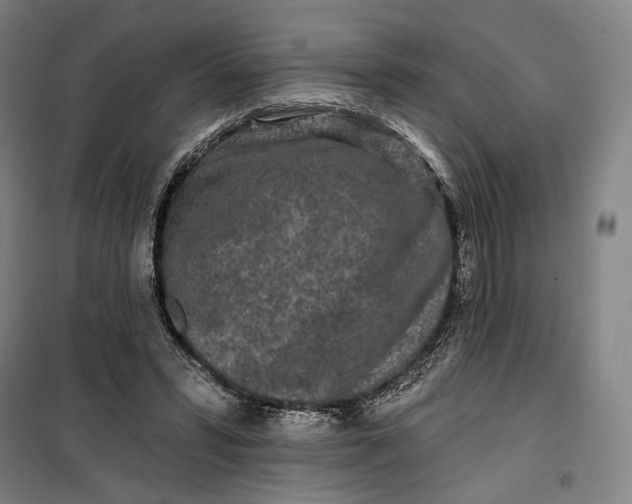 X0000099580399200806061631