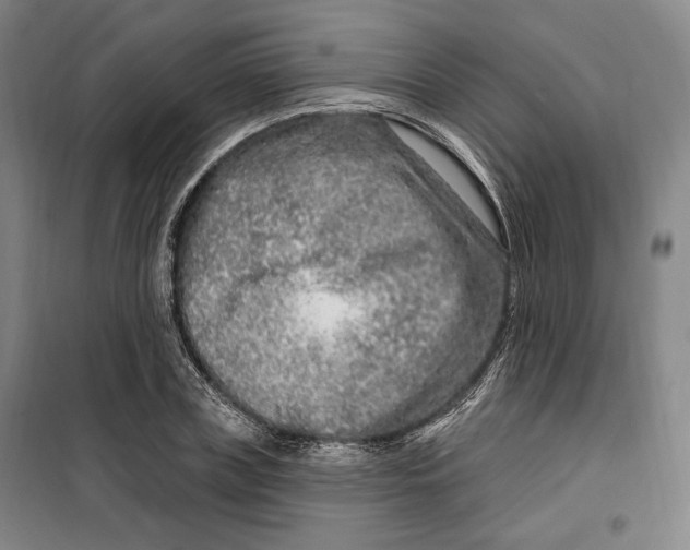 X0000099580835200806061625