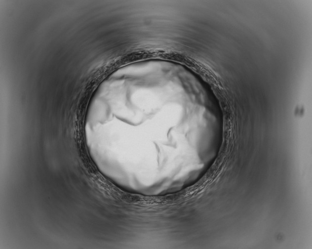 X0000099580917200806061623