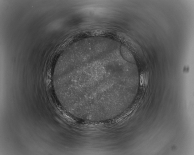 X0000099581011200806061622